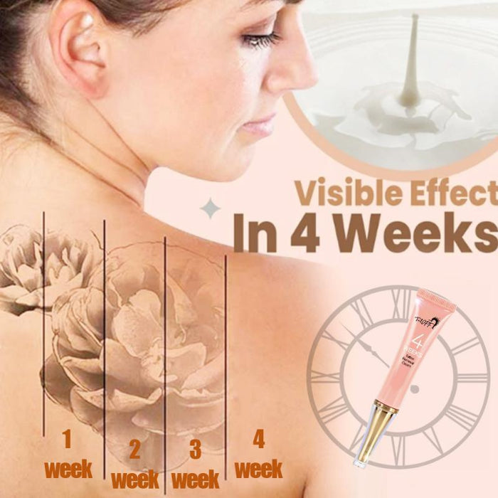 No Need For Pain Removal Maximum Strength Tattoo Inks Permanent Tattoo Removal Cream